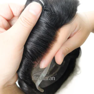 خط رویش پروتز مو هشتیکه